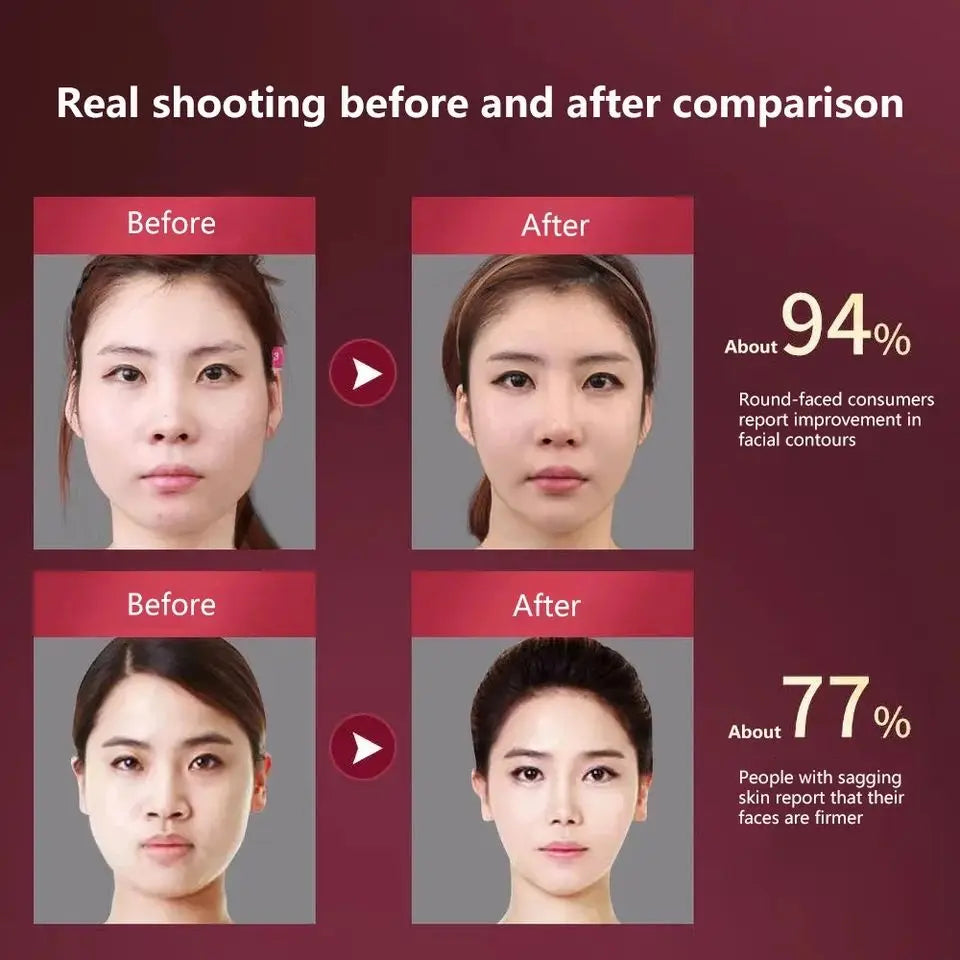 Vibelux ContourPro LED Facial Lifter